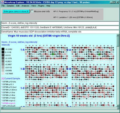 Pseudoarray image show intensity plot for Zscore Log normalized data 
for single sample